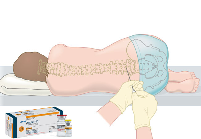 Buy Blincyto 35 MCG/38.5 MCG Injection in India